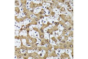 Immunohistochemistry of paraffin-embedded human liver using MAK antibody (ABIN7268382) at dilution of 1:100 (40x lens).