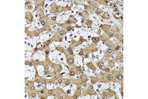 Immunohistochemistry of paraffin-embedded human liver using MAK antibody (ABIN7268382) at dilution of 1:100 (40x lens). (MAK anticorps  (AA 370-435))