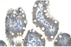 Human Intestine; ZNF498 antibody - middle region in Human Intestine cells using Immunohistochemistry (Zinc Finger and SCAN Domain Containing 25 (ZSCAN25) (Middle Region) anticorps)