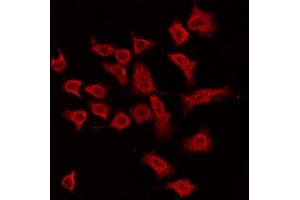ABIN6269391 staining MDA-MB-435 by IF/ICC.