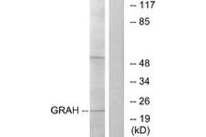 Western blot analysis of extracts from K562 cells, using GRAH Antibody. (GZMH anticorps  (AA 51-100))