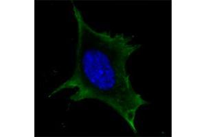 Confocal immunofluorescence analysis of 3T3-L1 cells using Calreticulin mouse mAb(green).