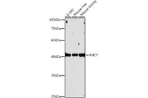 Western blot analysis of extracts of various cell lines, using AHCY antibody (ABIN1680618, ABIN1680617, ABIN7101497 and ABIN7101498) at 1:1000 dilution.