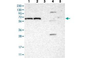Western blot analysis of Lane 1: RT-4, Lane 2: U-251 MG, Lane 3: Human Plasma, Lane 4: Liver, Lane 5: Tonsil with IFFO2 polyclonal antibody . (IFFO2 anticorps)
