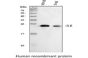 Western blot analysis of IL-6 using anti-IL-6 antibody (ABIN3042806).