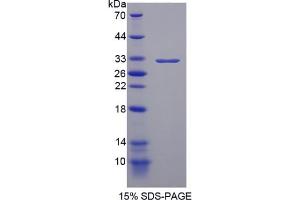 SDS-PAGE of Protein Standard from the Kit (Highly purified E.