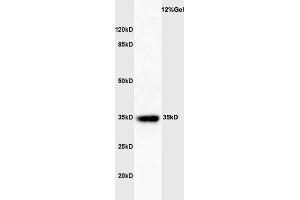 Mouse spleen lysates probed with Rabbit Anti-GATA-1 Polyclonal Antibody  at 1:3000 90min in 37˚C. (GATA1 anticorps  (AA 251-350))