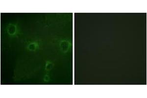 Immunofluorescence analysis of COS7 cells, using Kv2. (Kv2.1/KCNB1 anticorps  (AA 533-582))