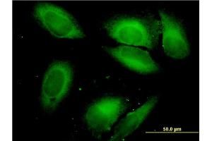 Immunofluorescence of monoclonal antibody to SARS on HeLa cell.