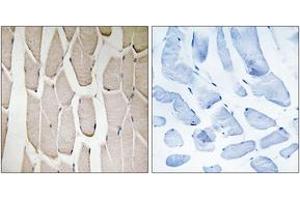 Immunohistochemistry analysis of paraffin-embedded human heart tissue, using MARCH3 Antibody. (MARCH3 anticorps  (AA 111-160))