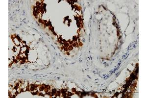 anti-ADP-Ribosyltransferase 3 (ART3) (AA 29-138) antibody