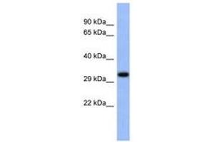 Image no. 1 for anti-Upstream Transcription Factor 1 (USF1) (C-Term) antibody (ABIN6742512) (USF1 anticorps  (C-Term))