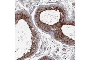 Immunohistochemical staining of human testis with FLVCR2 polyclonal antibody  shows strong cytoplasmic and membranous positivity in cells of seminiferus ducts. (FLVCR2 anticorps)
