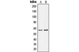 Western blot analysis of Kv1. (KCNA1 anticorps  (Center))