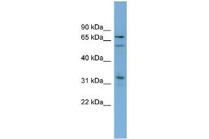 WB Suggested Anti-TBX18 Antibody Titration:  0. (T-Box 18 anticorps  (N-Term))