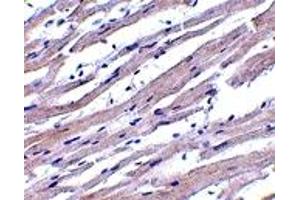 Immunohistochemistry (IHC) image for anti-Apoptotic Peptidase Activating Factor 1 (APAF1) (N-Term) antibody (ABIN1031229) (APAF1 anticorps  (N-Term))