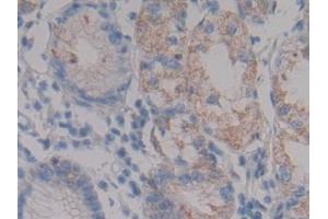 Detection of NPHN in Human Stomach Tissue using Polyclonal Antibody to Nephrin (NPHN)