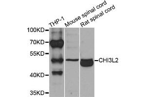 Western blot analysis of extracts of various cell lines, using CHI3L2 antibody (ABIN5975154) at 1/1000 dilution. (CHI3L2 anticorps)