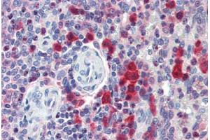 Human Spleen (formalin-fixed, paraffin-embedded) stained with CASP3 antibody ABIN462092 at 10 ug/ml followed by biotinylated goat anti-rabbit IgG secondary antibody ABIN481713, alkaline phosphatase-streptavidin and chromogen.