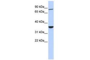 Image no. 1 for anti-RING Finger Protein 207 (RNF207) (AA 36-85) antibody (ABIN6740830) (RNF207 anticorps  (AA 36-85))