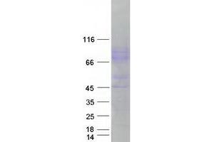 Validation with Western Blot