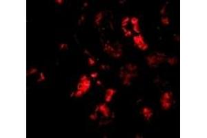 Immunofluorescence (IF) image for anti-Barrier To Autointegration Factor 1 (BANF1) (C-Term) antibody (ABIN1030282)