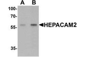 Western blot analysis of HEPACAM2 in mouse brain tissue lysate with HEPACAM2 Antibody  at (A) 0. (HEPACAM2 anticorps  (C-Term))
