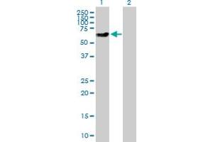 Western Blot analysis of XRCC4 expression in transfected 293T cell line by XRCC4 MaxPab polyclonal antibody. (XRCC4 anticorps  (AA 1-336))