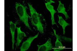 Immunofluorescence of monoclonal antibody to GSTA2 on HeLa cell.