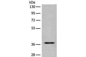 Western blot analysis of Jurkat cell lysate using EN2 Polyclonal Antibody at dilution of 1:400 (EN2 anticorps)