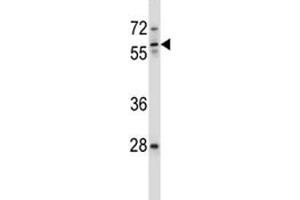 ICAM3 antibody western blot analysis in ZR-75-1 lysate.
