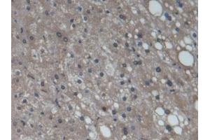 Detection of CYP3A7 in Human Liver Tissue using Monoclonal Antibody to Cytochrome P450 3A7 (CYP3A7)