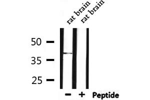 Western blot analysis of extracts from rat brain, using ACP5 Antibody.