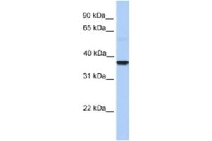 Western Blotting (WB) image for anti-Zinc Finger CCCH-Type Containing 15 (ZC3H15) antibody (ABIN2463354)