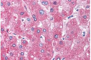 Human Liver (formalin-fixed, paraffin-embedded) stained with SERPINA1 antibody ABIN290682 at 5 ug/ml followed by biotinylated anti-goat IgG secondary antibody ABIN481715, alkaline phosphatase-streptavidin and chromogen.