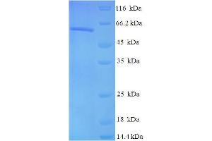 SDS-PAGE (SDS) image for Casein Kinase 2 alpha 1 (CSNK2A1) (AA 1-391), (full length) protein (His-SUMO Tag) (ABIN5709345)