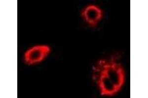 Immunofluorescent analysis of TCP1-delta staining in Hela cells. (CCT4 anticorps)