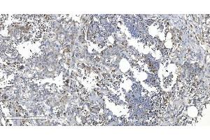 IHC analysis of ARG2 using anti-ARG2 antibody (ABIN7602662).