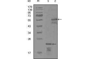 Western blot analysis using ERBB3 mouse mAb against truncated Trx-ERBB3 recombinant protein (1) and MBP-ERBB3 (aa1175-1275) recombinant protein (2). (ERBB3 anticorps)