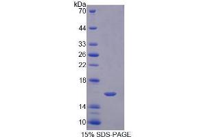 SDS-PAGE analysis of Human Neuropilin 1 Protein. (Neuropilin 1 Protein (NRP1))