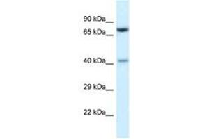 Image no. 1 for anti-Protein Arginine Methyltransferase 7 (PRMT7) (AA 380-429) antibody (ABIN6747434) (PRMT7 anticorps  (AA 380-429))