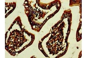 anti-Glycoprotein A33 (Transmembrane) (GPA33) (AA 22-235) antibody