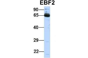 Host:  Rabbit  Target Name:  EBF2  Sample Type:  Human Fetal Lung  Antibody Dilution:  1. (EBF2 anticorps  (Middle Region))