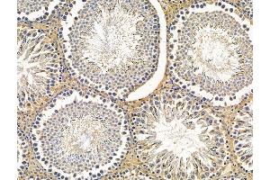 ABIN7096231 and ABIN7100293 at 1/100 staining rat testis tissue by IHC-P.