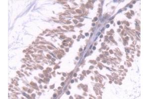 Detection of CD7 in Rat Testis Tissue using Polyclonal Antibody to Cluster Of Differentiation 7 (CD7) (CD7 anticorps  (AA 23-128))