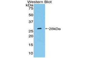 Western Blotting (WB) image for anti-Patched 1 (PTCH1) (AA 227-436) antibody (ABIN1860347) (Patched 1 anticorps  (AA 227-436))