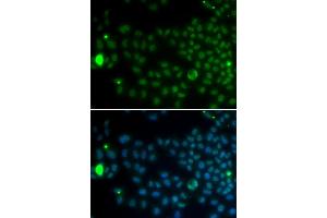 Immunofluorescence analysis of MCF-7 cells using SPDYA antibody. (SPDYA anticorps)