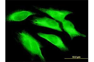 Immunofluorescence of monoclonal antibody to IL15 on HeLa cell. (IL-15 anticorps  (AA 49-162))