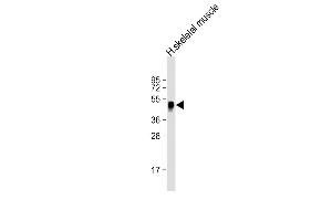 Anti-WNT11 Antibody (Center) at 1:2000 dilution + human skeletal muscle lysate Lysates/proteins at 20 μg per lane. (WNT11 anticorps  (AA 166-198))