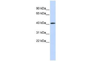 WB Suggested Anti-PAntibody Titration:  0. (PARP11 anticorps  (Middle Region))